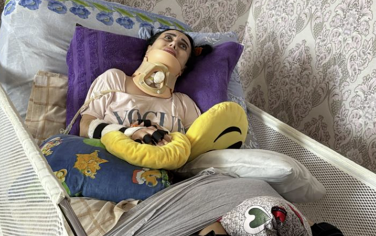 Rinoplastika əməliyyatından sonra iflic olan 34 yaşlı Nigar vəfat etdi